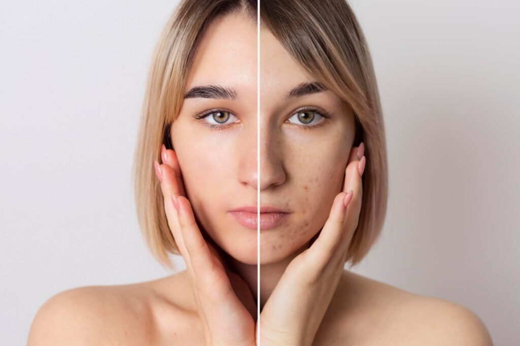 "Understanding the 5 Causes of Facial Hyperpigmentation: Expert Insights"